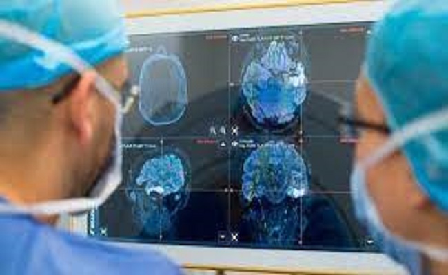 تطوير تقنية ثورية لقتل خلايا سرطان الدماغ دون جراحة‎‎...