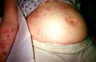بماذا تشعر الحامل؟ أعراض وتغيّرات شائعة طيلة فترة الحمل
