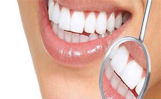 ابتسامة هوليوود...هل لها اضرار؟ اليكم الحقيقة