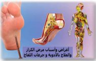 ما هو مرض الكزاز؟ وكيف يعمل لقاحه؟