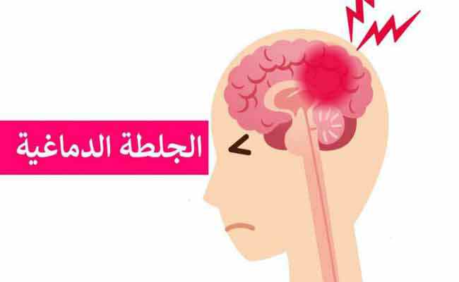 7 أشياء يمكنكم القيام بها للوقاية من السكتة الدماغية...