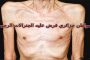 ذراع روبوتية تساعدك على تزويد سيارتك بالوقود‎‎...