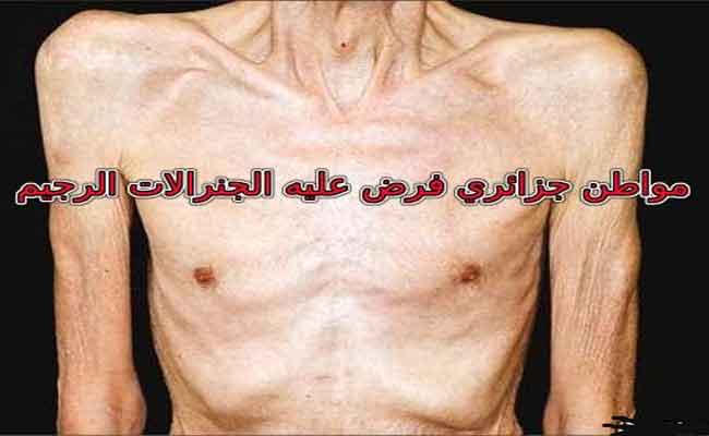 قمة السخرية الشعب الجزائري يعاني من الجوع والجنرالات يفرضون عليه الحمية