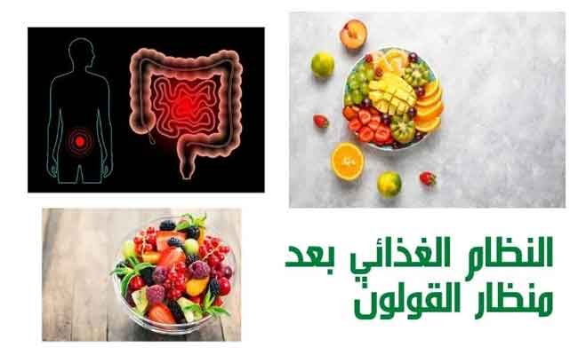 الأكل المناسب بعد منظار القولون...لتجنّب المضاعفات