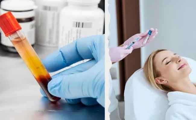 تقنية البلازما PRP علاج فعال في حالات تأخر الإنجاب...