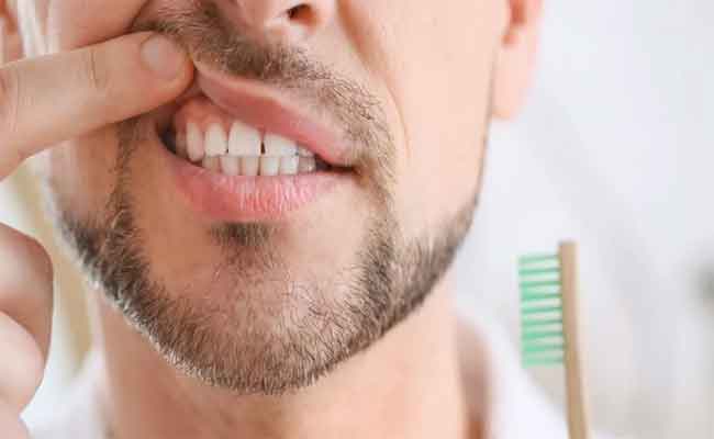 علاج اللثة الملتهبة بالأعشاب الطبيعية...فعّال بشكل مذهل