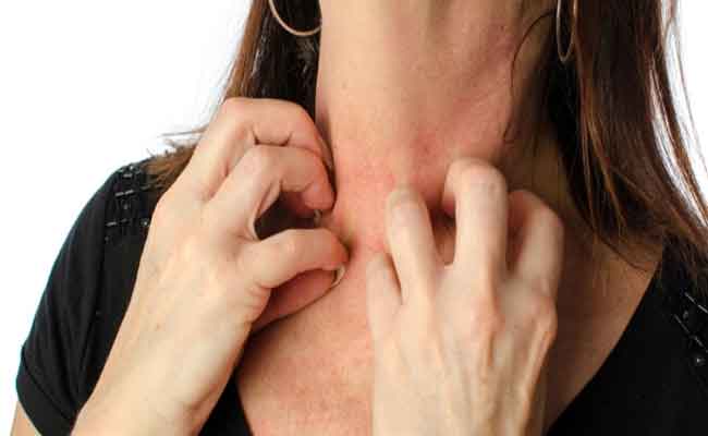 أي أعراض تشير الى حساسية الدمّ؟