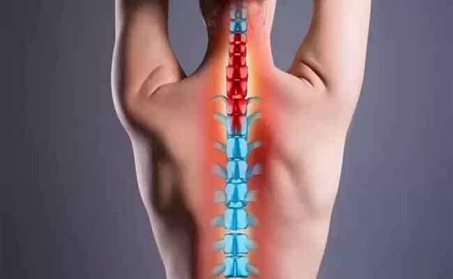 أعراض ديسك الرقبة مؤلمة...وتتطلب العناية الطبية