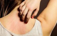 علاقة الحساسية بالحالة النفسية وطيدة...إليك الطرق العلاجية