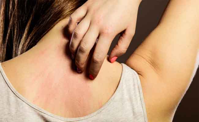 علاقة الحساسية بالحالة النفسية وطيدة...إليك الطرق العلاجية