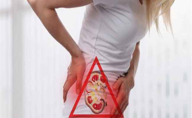 أعراض حصى الكلى عند النساء...الأسباب وطرق العلاج الصحيحة