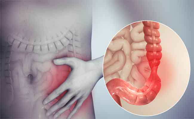 أعراض قرحة الاثني عشر خطيرة...تحتاج إلى العلاج الفوري
