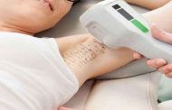 علاج التعرق الزائد تحت الإبط بخطوات بسيطة وفق طبيب متخصص