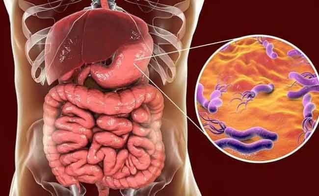 أفضل علاج لجرثومة المعدة...يساعدك على التعافي سريعاً
