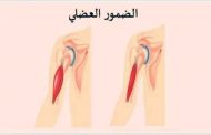 الفرق بين ضمور العضلات وضعف العضلات...التفاصيل وفق اختصاصية