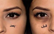 طرق علاج الهالات السوداء تحت العين في أسبوع...