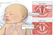 كيف يمكنك علاج احتقان الحلق عند طفلك الرضيع؟