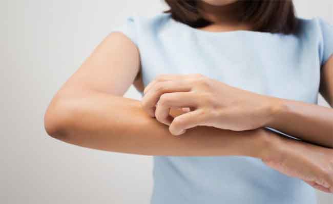 علاجات فعالة لتقليل الطفح الحراري بشكل طبيعي وبمكونات من مطبخك...