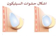 تثبيت الثدي بين تكبير حجمه وتصغيره Mastopexy...
