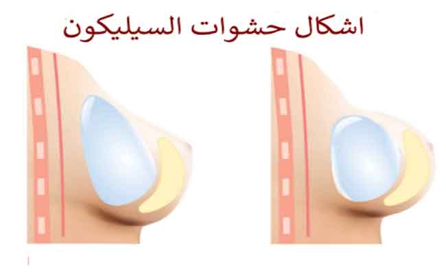 تثبيت الثدي بين تكبير حجمه وتصغيره Mastopexy...