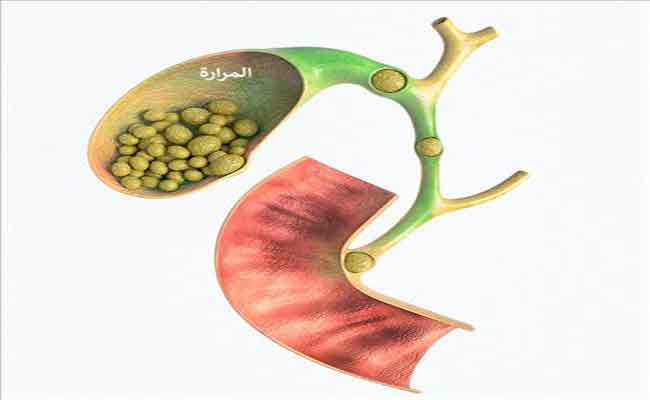 أعراض المرارة الصامتة لا يُمكن ملاحظتها...متى تستوجب العلاج؟