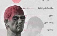 أسباب الصداع عديدة وبعضها خطير جداً...استشيري طبيبك