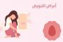 دراسة...هذا العنصر المفيد للأمعاء يمنع سرطان الثدي بفعالية