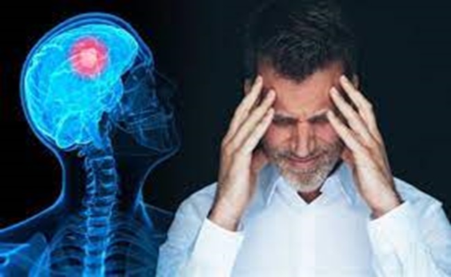الذكاء الاصطناعي يكشف أورام المخ بـ 90 ثانية...