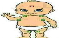 أماكن وضع الكمادات للرضع...