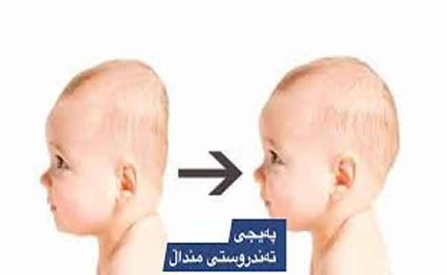 طرق حماية الطفل الرضيع من تسطح الرأس...