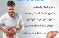 صحة الكبد: ابدئي يومك بـ3 مشروبات وفق طبيب جهاز هضمي