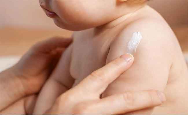 أسباب الشرى عند الأطفال وعلاجات طبيعية آمنة