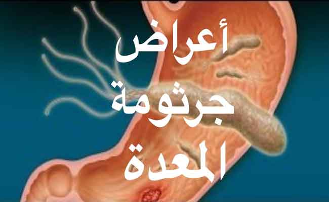 أعراض جرثومة المعدة على الرأس...قد تكون خطيرة