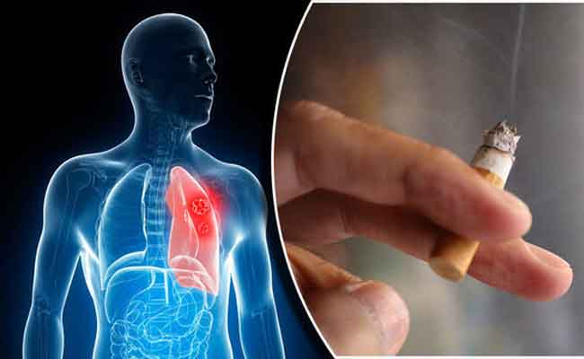 أضرار التدخين على الصحة التي يجهلها معظم المدخنين: طبيب يتحدث