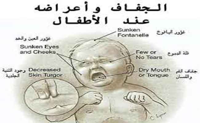 أعراض الجفاف التحذيرية عند الرضع...وكيفية التعامل معه