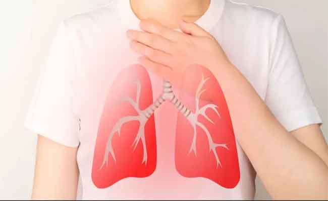 ما هي أعراض التهاب الشعب الهوائية؟ ومتى يجب زيارة الطبيب؟