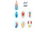 أعراض نقص الماء في الجسم وتجربتي مع علاج الجفاف بسرعة...