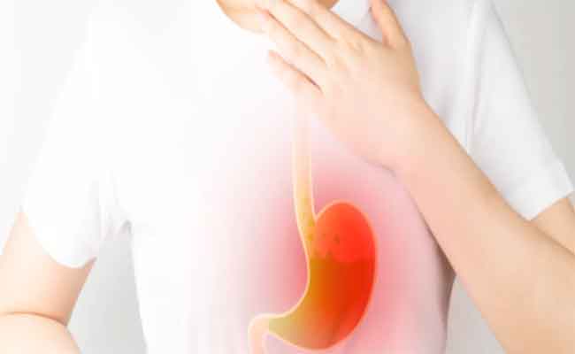 كيف أعرف أنني أعاني من ارتجاع المريء؟ وما العلاجات المتاحة؟