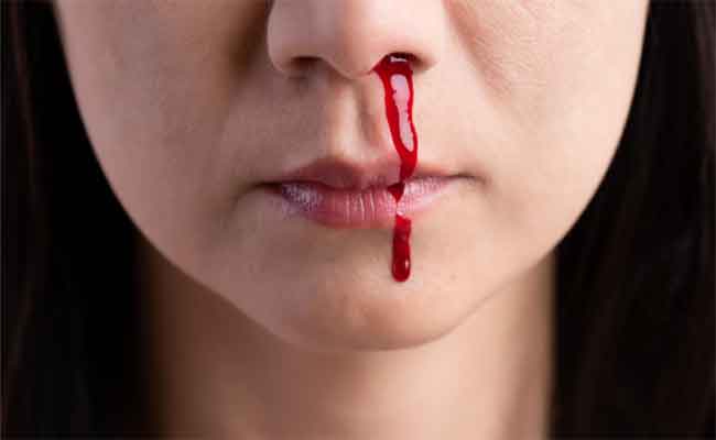 أسباب النزيف من فتحة أنف واحدة والعلاجات...