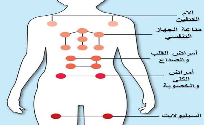 تجربتي مع الحجامة لأول مرة: أماكن الحجامة للنساء وأفضل الأوقات لإجرائها