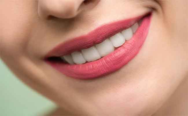 صحة أسنان العروس قبل الزواج: خطوة أساسية لبداية حياة زوجية صحية