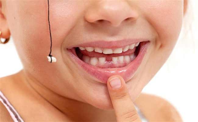 من دون ألم...إليك الطريقة الصحيحة لخَلع أسنان طفلك اللبنية