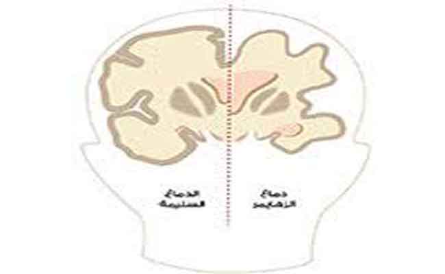 الزهايمر: علاج محتمل بناء على دراسات علمية حديثة