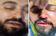 الاعتداء على مسافر جزائري على يد أحد موظفي شركة كورسيكا