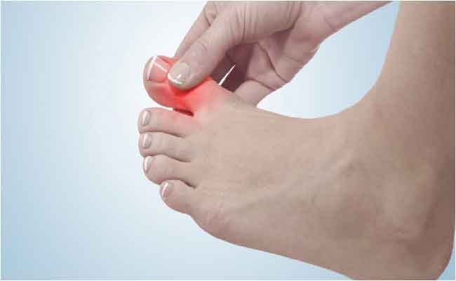 انتفاخ إصبع القدم الكبير...أسباب عديدة وبعضها خطير